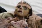 Growing number of Yemeni defected newborns