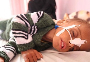 یمنی ها از سوء تغذیه شدید رنج می برند