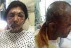 Londres : deux musulmans attaqués à l’acide