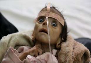 یمن کی صورتحال ، انسانی تاریخ کا بدترین بحران