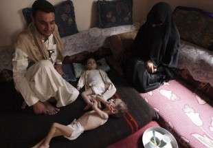 یمن پر سعودی جارحیت سے 5ہزار سے زائد بچے جاں بحق