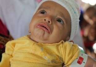 “يونيسف”: 2.6 مليون طفل يموتون سنوياً في شهرهم الأول حول العالم