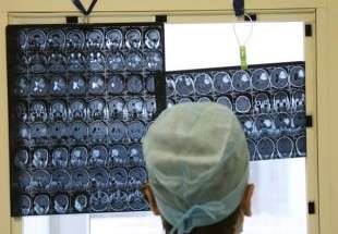 جراحون هنود ينجحون في إزالة أكبر ورم دماغي