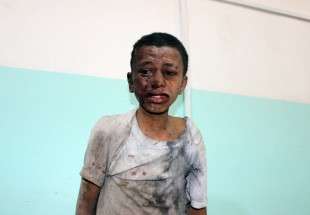 Yémen : au moins 50 personnes, en majorité des enfants, ont été tuées par des frappes de la coalition saoudienne