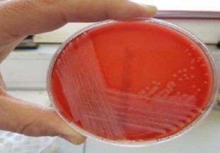 اكتشاف نوع غير معروف من البكتيريا!
