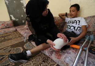 منظمة حقوقية: إسرائيل تسعى لتحويل أطفال فلسطين لمعاقين
