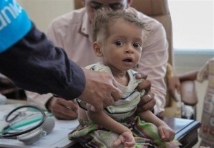 3 میلیون کودک یمنی دچار سوء تغذیه اند