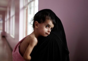 LA famine, le plus grand crime de guerre dans le conflit du Yémen