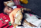 ICRC: Yemen suffers from triad death, destruction and hunger