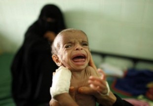 85 ہزار معصوم یمنی بچے سعودی عرب کےبھیانک جرائم کا شکار