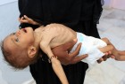 سلامت میلیون ها کودک یمنی در خطر است/ طرح شکایت از ائتلاف سعودی