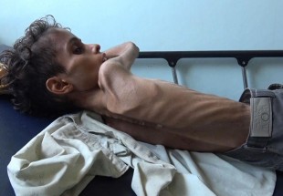 Yemen calls for more humanitarian aid from Turkey