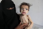 الهلال الأحمر التركي: ثلثا سكان اليمن يعانون انعدام الأمن الغذائي والجوع