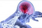 9 أعراض تنذر بسرطان الدماغ