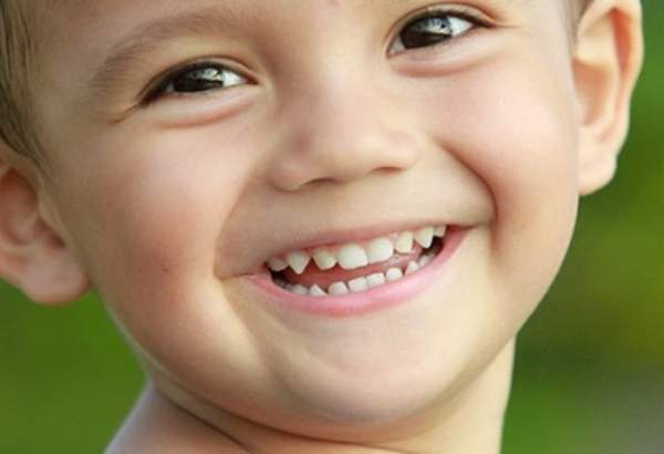 ما العلاقة بين أسنان الأطفال وصحّتهم النفسيّة والعقليّة؟