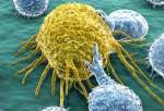 امید تازه دانشمندان برای نابودی سلول‌های سرطانی