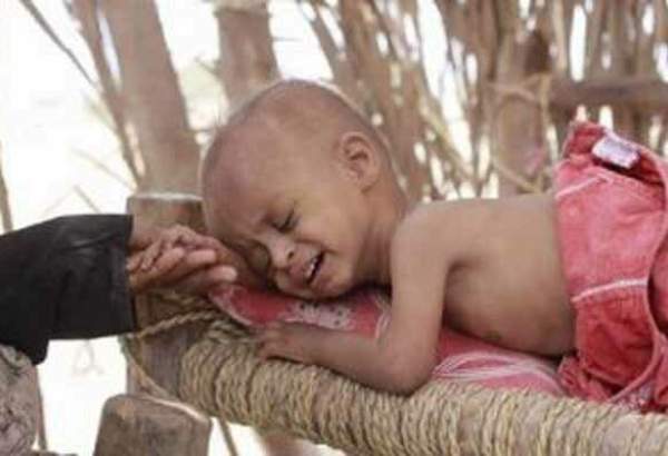 جنگ بیولوژیک ضد یمن/هزاران کودک قربانی شده‌اند