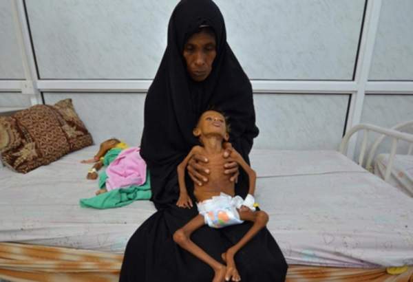 هر دو ساعت یک مادر و ۶ نوزاد در یمن می میرند