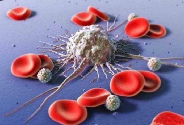 شیوه جدید درمان سرطان خون