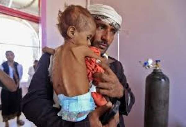 Over 3,600 Yemeni children killed, 800 paralyzed during Saudi aggression