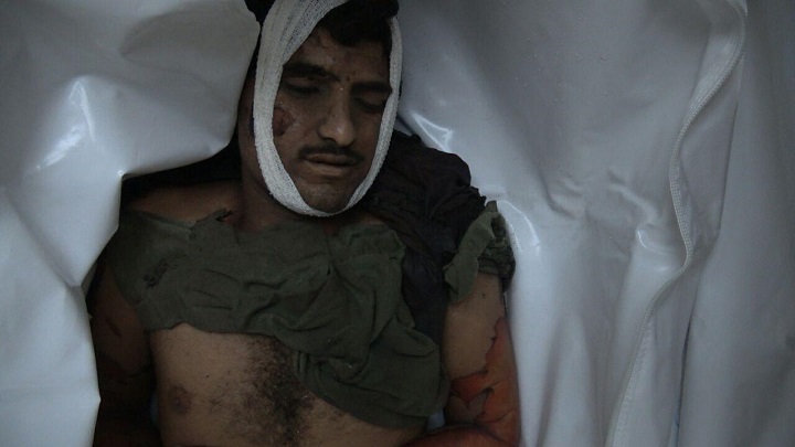 عشرات الشهداء والجرحى في جريمة جديدة للعدوان بصعدة (اليمن)