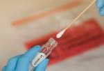 پاکستان کا کورونا وائرس ویکسین کی ایڈوانس بکنگ کا فیصلہ