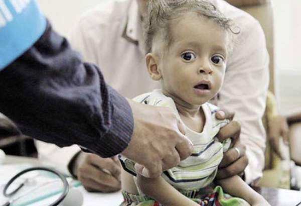 هشدار سازمان ملل نسبت به وقوع قحطی در یمن