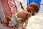 Famine, death threaten lives of 400K Yemeni children