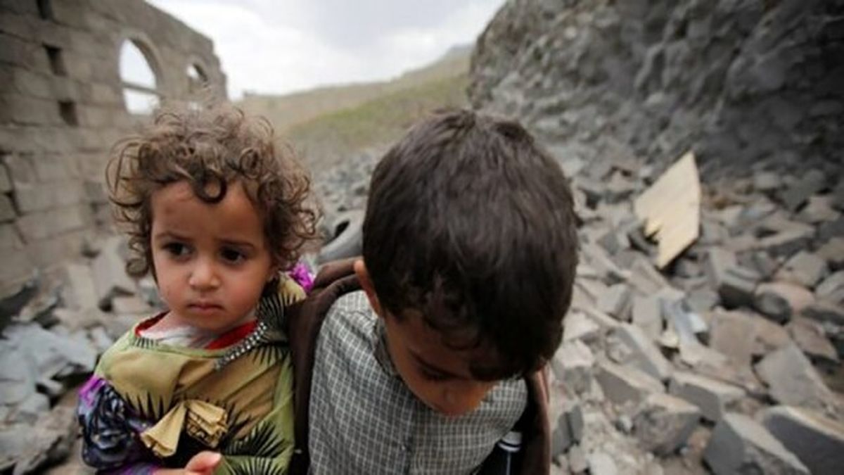 هشدار سازمان ملل درباره سوء تغذیه بیش از 7 میلیون یمنی