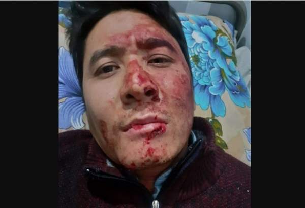 تصویربردار خبرگزاری صدا و سیما در کابل ترور شد