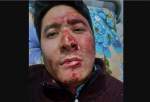 تصویربردار خبرگزاری صدا و سیما در کابل ترور شد