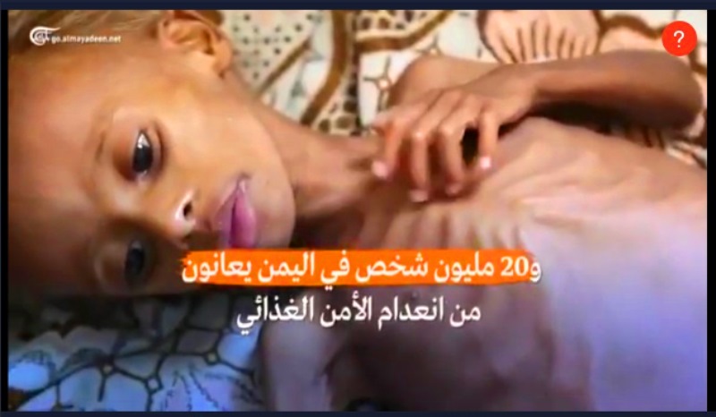 أمل:كيف ينام الضمير العالمي وأطفال اليمن أمام كوارث لا تحتمل؟!!  