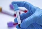 US researchers find possible universal monoclonal antibody coronavirus treatment