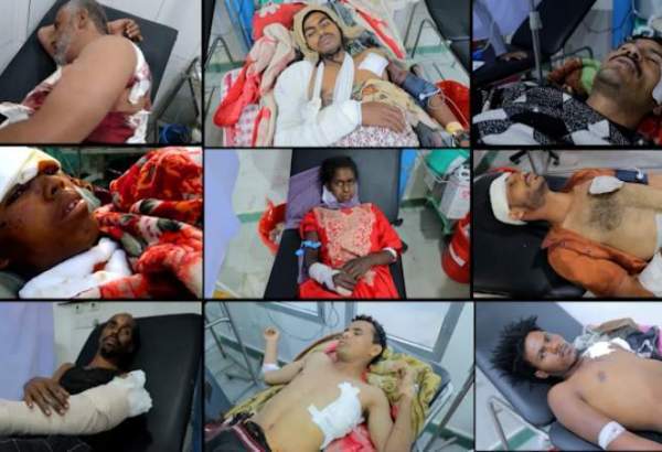 149 کشته و مجروح یمنی در اثر بمباران سعودی در دو ماه گذشته