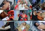 149 کشته و مجروح یمنی در اثر بمباران سعودی در دو ماه گذشته