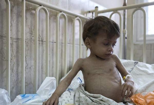 غزہ کی پٹی میں دو سال سے کم عمر کے ہر تین بچوں میں سے ایک غذائی قلت کا شکار