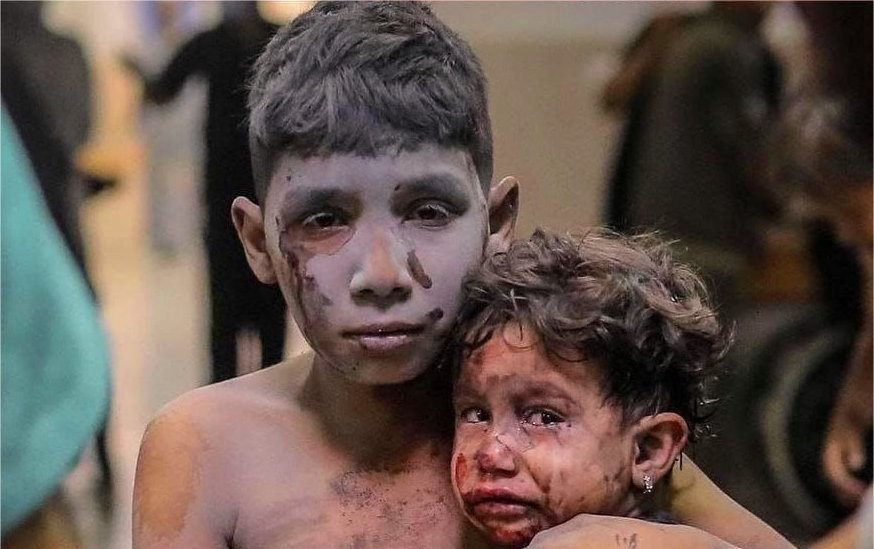 مدير الصحة العالمية : التاريخ سيحاكمنا بشأن معاناة أطفال غزة