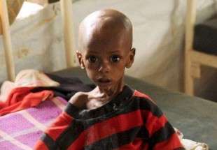 خطر مرگ ۲۰۰ هزار کودک سومالیایی را تهدید می کند
