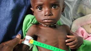 Five million people starving in Mali: UNICEF