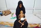 Abysmal Condition of Yemeni Children (Photo)  <img src="/images/picture_icon.png" width="13" height="13" border="0" align="top">