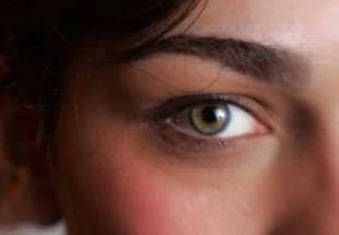 نصائح بسيطة تجنب النساء "هالات العين السوداء"