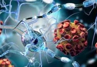 Iranian scientists bring new hope for MS affected patients