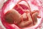 ​کدام دارو ها باعث سقط جنین می شوند؟