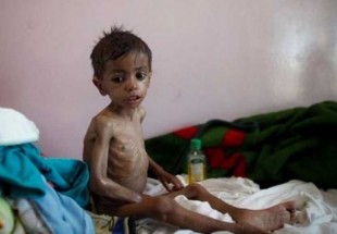 "أنقذوا الأطفال": المجاعة تتهدد مليون طفل إضافي في اليمن‎