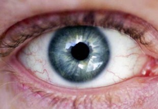 شبكية "الخلايا الجذعية".. أمل جديد للمصابين بالعمى