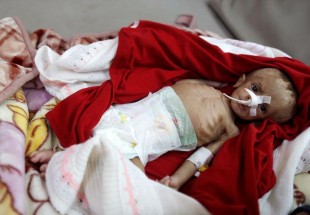 UN humanitarian chief: Famine threatens 14m in Yemen