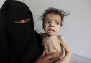 UK-based charity says 85’000 Yemeni kids died of malnutrition
