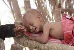 جنگ بیولوژیک ضد یمن/هزاران کودک قربانی شده‌اند