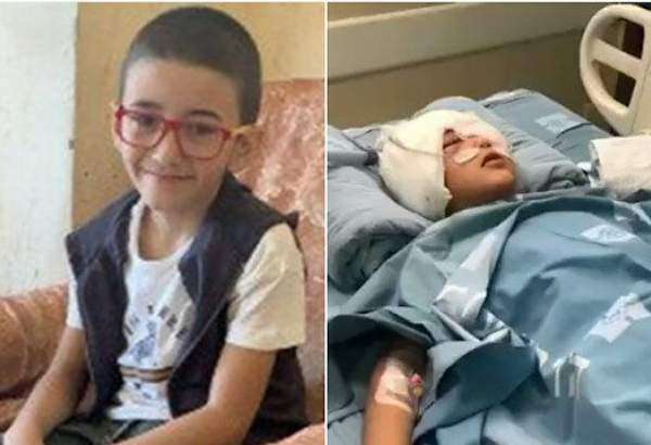 Palestinian boy shot by Israeli forces loses left eye