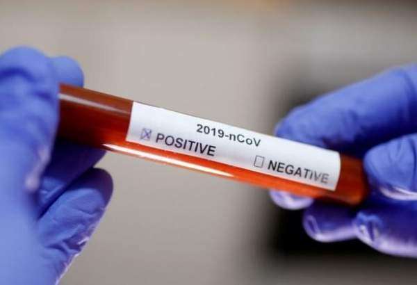 آزمایش مثبت دو مورد کرونا ویروس در ایران